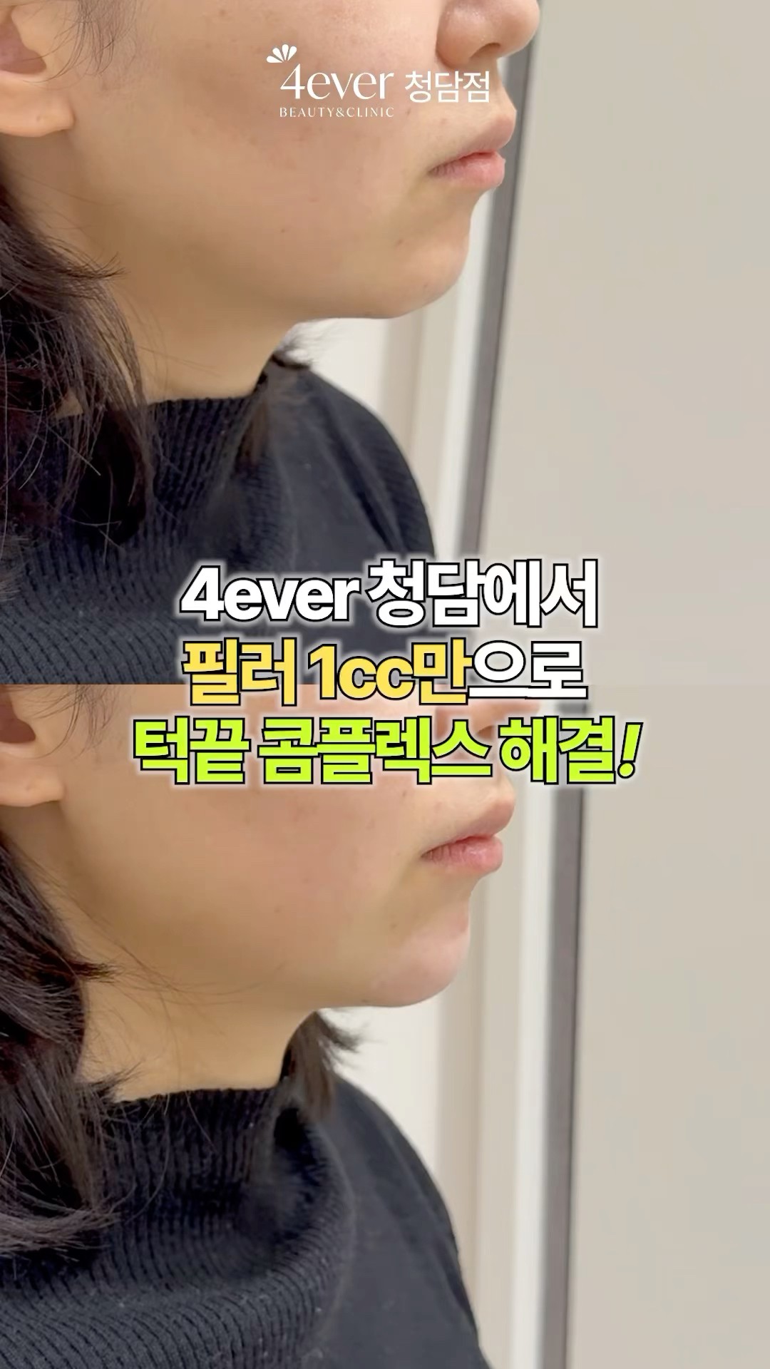 유튜브쇼츠