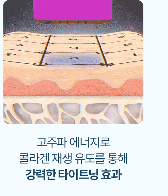 울써마지